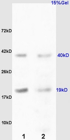 L1 rat kidney lysates L2 rat liver lysates probed with Anti RCL/c Myc responsive Polyclonal Antibody, Unconjugated (bs-7827R) at 1:200 overnight at 4˚C. Followed by conjugation to secondary antibody (bs-0295G-HRP) at 1:3000 for 90 min at 37˚C. Predicted band 19kD. Observed band size:19kD,40kD.\n L1 rat kidney lysates L2 rat liver lysates probed with Anti RCL/c Myc responsive Polyclonal Antibody, Unconjugated (bs-7827R) at 1:200 overnight at 4˚C. Followed by conjugation to secondary antibody (bs-0295G-HRP) at 1:3000 for 90 min at 37˚C. Predicted band 19kD. Observed band size:19kD,40kD.\n