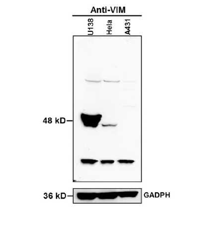 20 \u03bcg proteins of cell lysates from U138, HeLa and A431 were separated by SDS-PAGE and transferred to PVDF membrane for western blotting analysis antibodies against protein VIM at dilution of 1:1000 with exposure time of 10 seconds.
