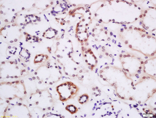 Formalin-fixed and paraffin embedded human kidney labeled with Anti-DTX3L Polyclonal Antibody, Unconjugated (bs-14438R) at 1:200 followed by conjugation to the secondary antibody and DAB staining.