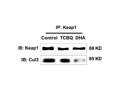This image was generously provided by Yang Song, Ph.D. at Southwest University in Chong Qing, China. HepG2 cells were incubated with Rabbit Anti-KEAP1 Polyclonal Antibody (bs-3648R) at 4°C overnight and then mixed with Protein A agarose beads at 4°C for 3hrs. The solutions were centrifuged and the pellets were washed with lysis buffer, heated, and subsequently analyzed by Western blotting.