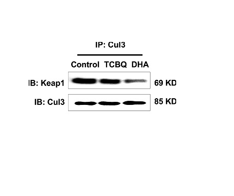 This image was generously provided by Yang Song, Ph.D. at Southwest University in Chong Qing, China. HepG2 cells were incubated with Rabbit Anti-Cullin 3 Polyclonal Antibody (bs-4211R) at 4°C overnight and then mixed with Protein A agarose beads at 4°C for 3hrs. The solutions were centrifuged and the pellets were washed with lysis buffer, heated, and subsequently analyzed by Western blotting.