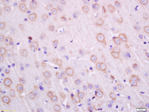 Formalin-fixed and paraffin embedded rat brain labeled with Anti-Transmembrane Protein 30A Polyclonal Antibody, Unconjugated (bs-16576R) at 1:200 followed by conjugation to the secondary antibody and DAB staining.