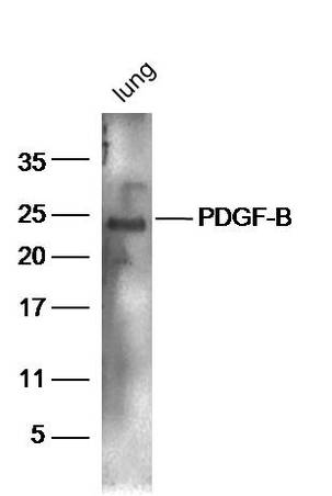 Mouse lung lysates probed with Rabbit Anti-PDGF-B Polyclonal Antibody, Unconjugated (bs-0185R) at 1:300 overnight at 4˚C. Followed by conjugation to secondary antibody (bs-0295G-HRP) at 1:5000 for 90 min at 37˚C.