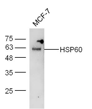 MCF-7 Lysates probed with Rabbit Anti-HSP60 Polyclonal Antibody (bs-0191R) at 1:300 overnight at 4˚C. Followed by conjugation to secondary antibody (bs-0295G-HRP) at 1:5000 for 90 min at 37˚C.