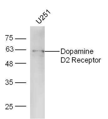 U251 lysates probed with Rabbit Anti-DRD2 Polyclonal Antibody, Unconjugated (bs-1008R) at 1:300 overnight at 4˚C. Followed by conjugation to secondary antibody (bs-0295G-HRP) at 1:5000 for 90 min at 37˚C.