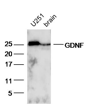 Lane 1:U251 lysates and Lane 2: Mouse brain lysates probed with Rabbit Anti-GDNF Polyclonal Antibody, Unconjugated (bs-1024R) at 1:300 overnight at 4˚C. Followed by conjugation to secondary antibody (bs-0295G-HRP) at 1:5000 for 90 min at 37˚C.