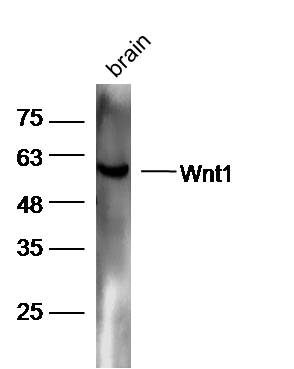 Mouse brain lysates probed with Rabbit Anti-Wnt1 Polyclonal Antibody, Unconjugated (bs-1739R) at 1:300 overnight at 4˚C. Followed by conjugation to secondary antibody (bs-0295G-HRP) at 1:5000 for 90 min at 37˚C.