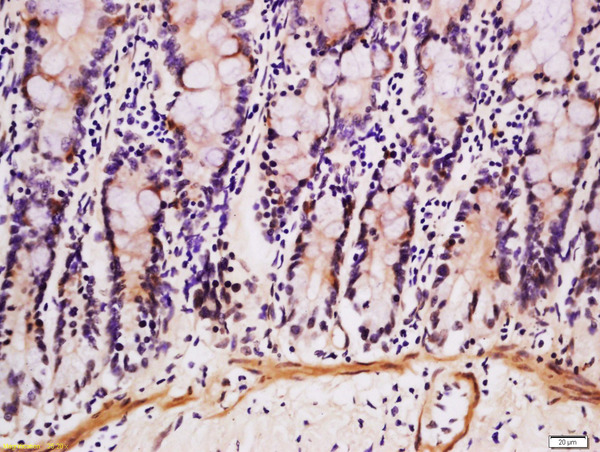 Formalin-fixed and paraffin embedded mouse intestine labeled with Anti-DEFB124 Polyclonal Antibody, Unconjugated (bs-14252R) at 1:200 followed by conjugation to the secondary antibody and DAB staining