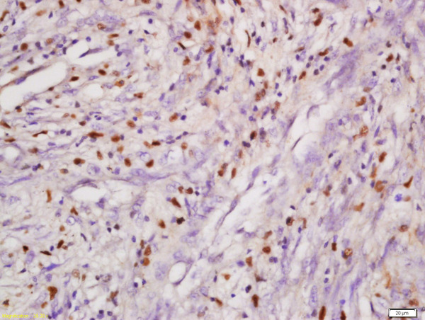 Formalin-fixed and paraffin embedded mouse intestine labeled with Anti-DHX8 Polyclonal Antibody, Unconjugated (bs-14324R) at 1:200 followed by conjugation to the secondary antibody and DAB staining.
