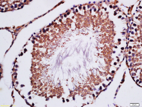 Formalin-fixed and paraffin embedded rat testis labeled with Anti-ELAC1 Polyclonal Antibody, Unconjugated (bs-14555R) at 1:200 followed by conjugation to the secondary antibody and DAB staining