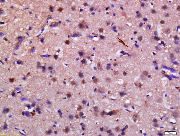 Formalin-fixed and paraffin embedded rat brain labeled with Anti-Syndetin Polyclonal Antibody, Unconjugated (bs-16108R) at 1:200 followed by conjugation to the secondary antibody and DAB staining.