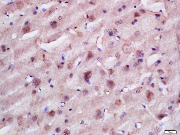 Formalin-fixed and paraffin embedded rat brain labeled with Anti-TACO1 Polyclonal Antibody, Unconjugated (bs-16128R) at 1:200 followed by conjugation to the secondary antibody and DAB staining.
