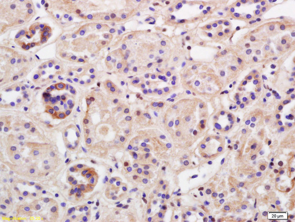 Formalin-fixed and paraffin embedded human kidney labeled with Rabbit Anti TRIM41 Polyclonal Antibody, Unconjugated (bs-9151R) at 1:200 followed by conjugation to the secondary antibody and DAB staining