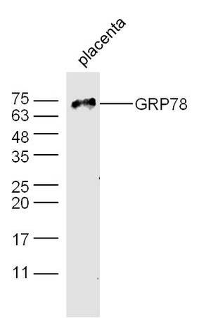 Mouse placenta probed with Rabbit Anti-GRP78 Polyclonal Antibody, Unconjugated (bs-1219R) at 1:300 overnight at 4˚C. Followed by conjugation to secondary antibody (bs-0295G-HRP) at 1:500 for 90 min at 37˚C.
