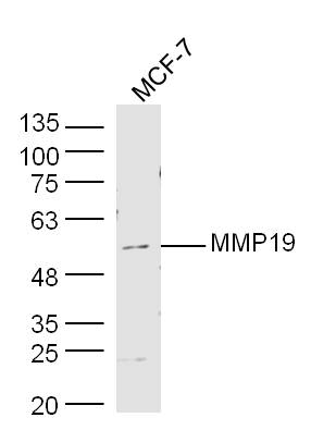 Human MCF-7 cell lysates probed with Rabbit Anti-MMP19  Polyclonal Antibody, Unconjugated (bs-10058R) at 1:300 overnight at 4˚C. Followed by conjugation to secondary antibody (bs-0295G-HRP) at 1:500 for 90 min at 37˚C.