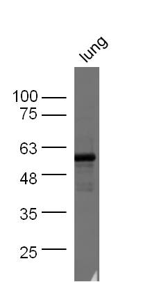 Mouse lung probed with Rabbit Anti-CD93/C1qrp Polyclonal Antibody, Unconjugated (bs-10232R) at 1:300 overnight at 4˚C. Followed by conjugation to secondary antibody (bs-0295G-HRP) at 1:500 for 90 min at 37˚C.