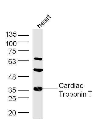 Mouse heart lysates probed with Rabbit Anti-Troponin T Polyclonal Antibody, Unconjugated (bs-10648R) at 1:300 overnight at 4˚C. Followed by conjugation to secondary antibody (bs-0295G-HRP) at 1:500 for 90 min at 37˚C.