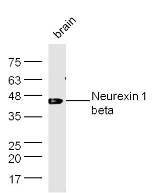 Mouse brain lysates probed with Rabbit Anti-Neurexin 1 beta Polyclonal Antibody, Unconjugated (bs-11466R) at 1:300 overnight at 4˚C. Followed by conjugation to secondary antibody (bs-0295G-HRP) at 1:500 for 90 min at 37˚C.