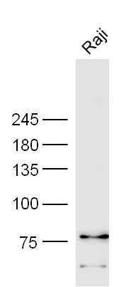 Raji cell lysates probed with Anti-CD85c Polyclonal Antibody, Unconjugated (bs-2658R) at 1:200 in 4˚C. Followed by conjugation to secondary antibody (bs-0295G-HRP) at 1:3000 90min in 37˚C. Raji cell lysates probed with Anti-CD85c Polyclonal Antibody, Unconjugated (bs-2658R) at 1:200 in 4˚C. Followed by conjugation to secondary antibody (bs-0295G-HRP) at 1:3000 90min in 37˚C.