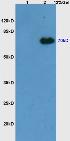 L1 mouse embryo lysates L2 mouse thymus lysates probed with Anti Phospho-Syk (Tyr525/526) Polyclonal Antibody, Unconjugated (bs-3434R) at 1:200 overnight at 4˚C. Followed by conjugation to secondary antibody (bs-0295G-HRP) at 1:3000 for 90 min at 37˚C. Predicted band 70kD. Observed band size:70kD.\n