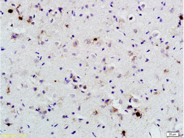 Formalin-fixed and paraffin embedded rat brain labeled with  Rabbit Anti BNP Polyclonal Antibody, Unconjugated (bs-2207R) at 1:200 followed by conjugation to the secondary antibody and DAB staining