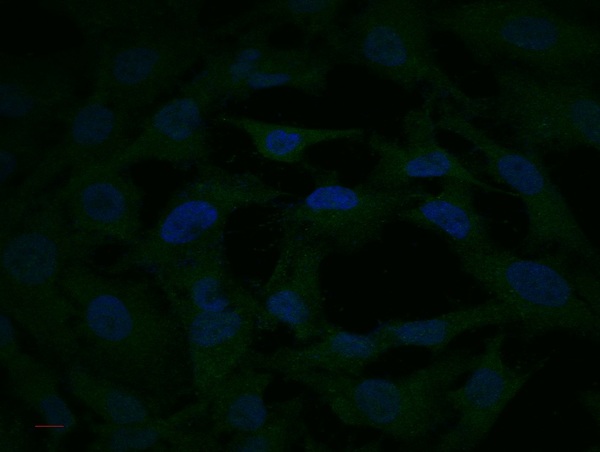 HT-55 cells were stained with bs-0223R Rabbit Anti-MEK2 Polyclonal Antibody at 1:250. Followed by Goat Anti-Rabbit antibody conjugated to Alexa fluor 488 at 1:500 dilution.