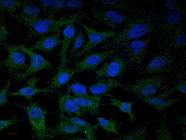 Image submitted by One World Lab validation program. HL60 and MCF-7 cells were stained with rabbit polyclonal antibody against TLR4 with two dilutions (1:100 and 1:250). 2nd antibody without primary antibody was used as control included here.