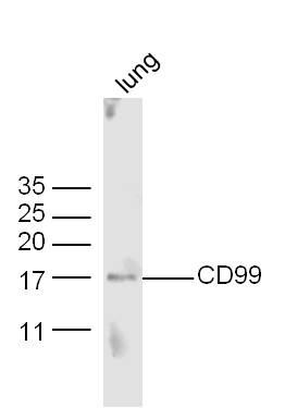 Mouse lung lysates probed with Anti-CD99 Polyclonal Antibody, Unconjugated (bs-2523R) at 1:300 in 4˚C. Followed by conjugation to secondary antibody (bs-0295G-HRP) at 1:5000 90min in 37˚C.
