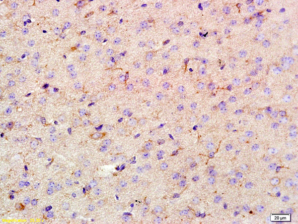 Formalin-fixed and paraffin-embedded rat brain labeled with AIF1 Polyclonal Antibody at 1:200 dilution followed by incubation with secondary antibody and DAB staining