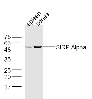 Mouse spleen and bone lysates probed with Rabbit Anti-SIRP Alpha Polyclonal Antibody, Unconjugated (bs-2708R) at 1:300 overnight at 4˚C. Followed by conjugation to secondary antibody (bs-0295G-HRP) at 1:500 for 90 min at 37˚C.