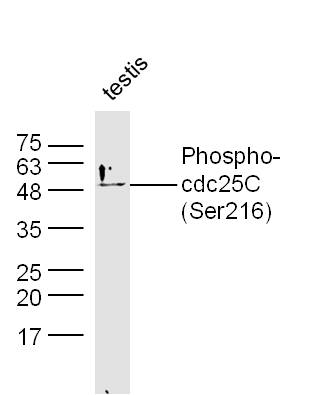 Mouse testis lysates probed with Rabbit Anti-cdc25C (Ser216) Polyclonal Antibody, Unconjugated (bs-3096R) at 1:300 overnight at 4˚C. Followed by conjugation to secondary antibody (bs-0295G-HRP) at 1:500 for 90 min at 37˚C.