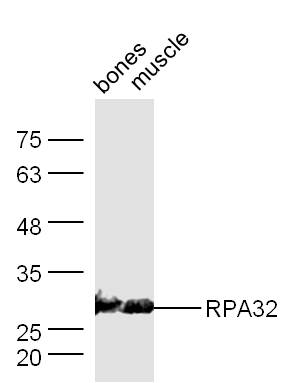 Mouse bone/muscle lysates 30ug, probed with Anti-RPA32 Polyclonal Antibody (bs-4182R) at 1:300 overnight in 4˚C. Followed by conjugation to the secondary antibody (bs-0295G-HRP) at 1:5000 90min in 37˚C.