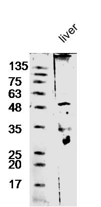 Mouse liver lysate probed with Anti-Antithrombin III Polyclonal Antibody (bs-1636R) at 1:300 overnight in 4˚C. Followed by conjugation to the secondary antibody (bs-0295G-HRP) at 1:5000 90min in 37˚C.