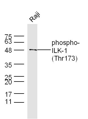 Raji cell lysates probed with Rabbit Anti-ILK-1(Thr173) Polyclonal Antibody, Unconjugated (bs-5443R) at 1:300 overnight at 4˚C. Followed by conjugation to secondary antibody (bs-0295G-HRP) at 1:500 for 90 min at 37˚C.